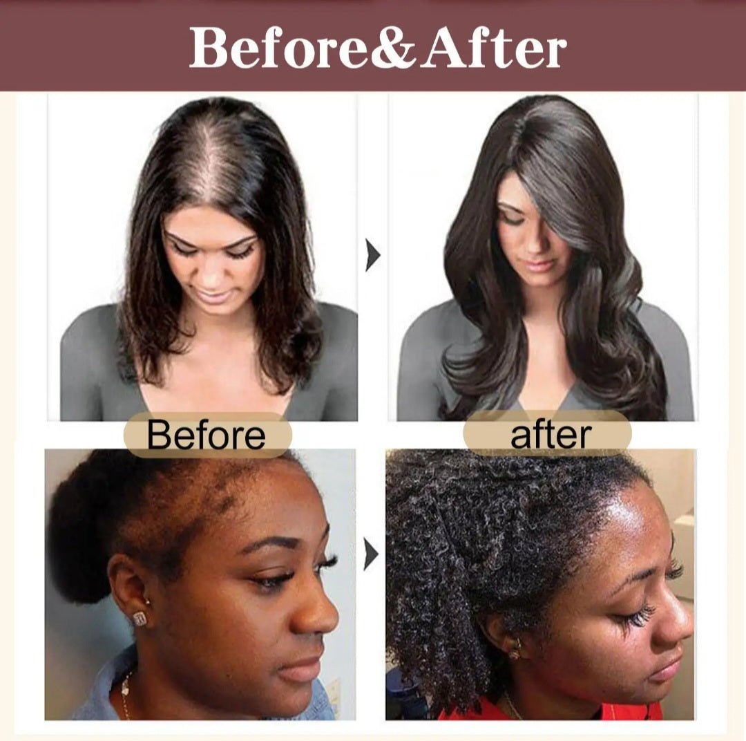 Batana Oil 100% Natural Hair Growth Repair Dry Damaged Hair Scalp Treatment 118ml - IDY V. FIT NATURALS